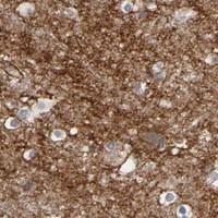 HPA IHC Cerebral cortex — GNG2