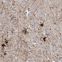 HPA IHC Cerebral cortex — MCAT