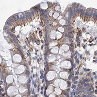 HPA IHC Colon — ACOT9