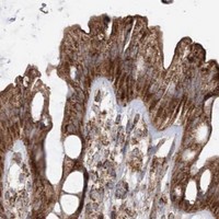 HPA IHC Colon — AARS2