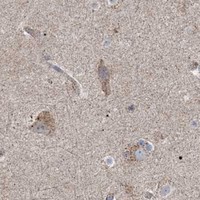 HPA IHC Cerebral cortex — AARS2