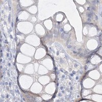 HPA IHC Colon — TRIM2