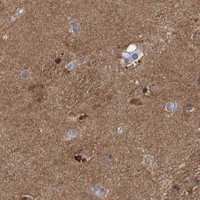 HPA IHC Caudate — TRIM2