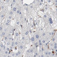 HPA IHC Liver — SETD3