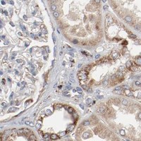 HPA IHC Kidney — SETD3