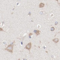HPA IHC Cerebral cortex — SETD3