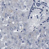 HPA IHC Liver — SNAP25