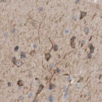 HPA IHC Cerebral cortex — FGF19