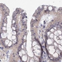HPA IHC Colon — SLC7A7