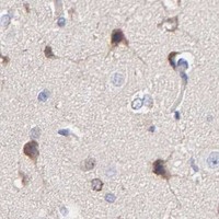 HPA IHC Cerebral cortex — TIMM8A