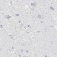 HPA IHC Cerebral cortex — CMA1