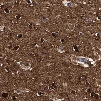HPA IHC Cerebral cortex — GUSB