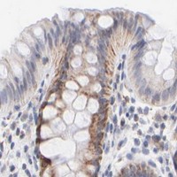HPA IHC Colon — MRPL58