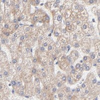 HPA IHC Liver — MRPL58