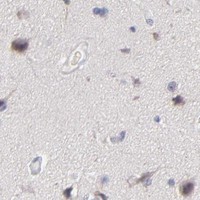 HPA IHC Cerebral cortex — MRPL58