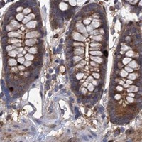 HPA IHC Colon — GCLC