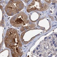 HPA IHC Kidney — GCLC