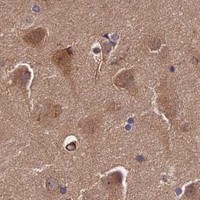 HPA IHC Cerebral cortex — WDR1