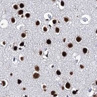 HPA IHC Cerebral cortex — MATR3