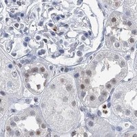 HPA IHC Kidney — HAT1