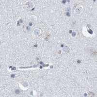 HPA IHC Cerebral cortex — HAT1