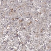 HPA IHC Liver — AP2M1