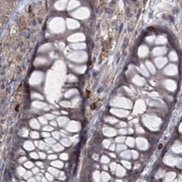 HPA IHC Colon — AP2M1