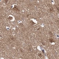 HPA IHC Cerebral cortex — AP2M1