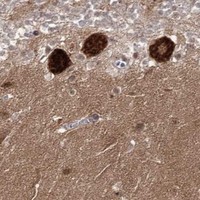 HPA IHC Cerebellum — AP2M1