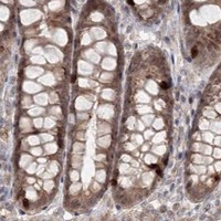 HPA IHC Colon — KIF20A