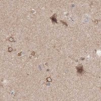HPA IHC Cerebral cortex — KIF20A