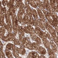 HPA IHC Liver — HMGCS1
