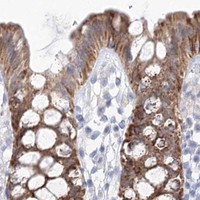HPA IHC Colon — HMGCS1