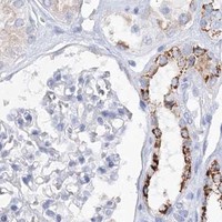 HPA IHC Kidney — HMGCS1