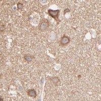 HPA IHC Cerebral cortex — CLTB
