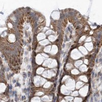 HPA IHC Colon — OPA1