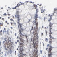 HPA IHC Colon — ORC2
