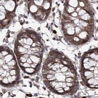 HPA IHC Colon — TRNT1