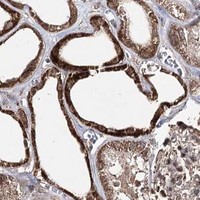 HPA IHC Kidney — TRNT1