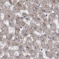 HPA IHC Liver — TRNT1