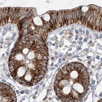 HPA IHC Colon — PCCB