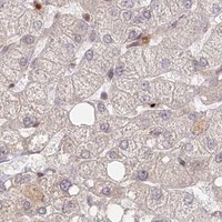 HPA IHC Liver — CEP70