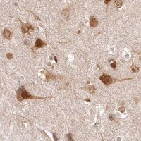 HPA IHC Cerebral cortex — CEP70