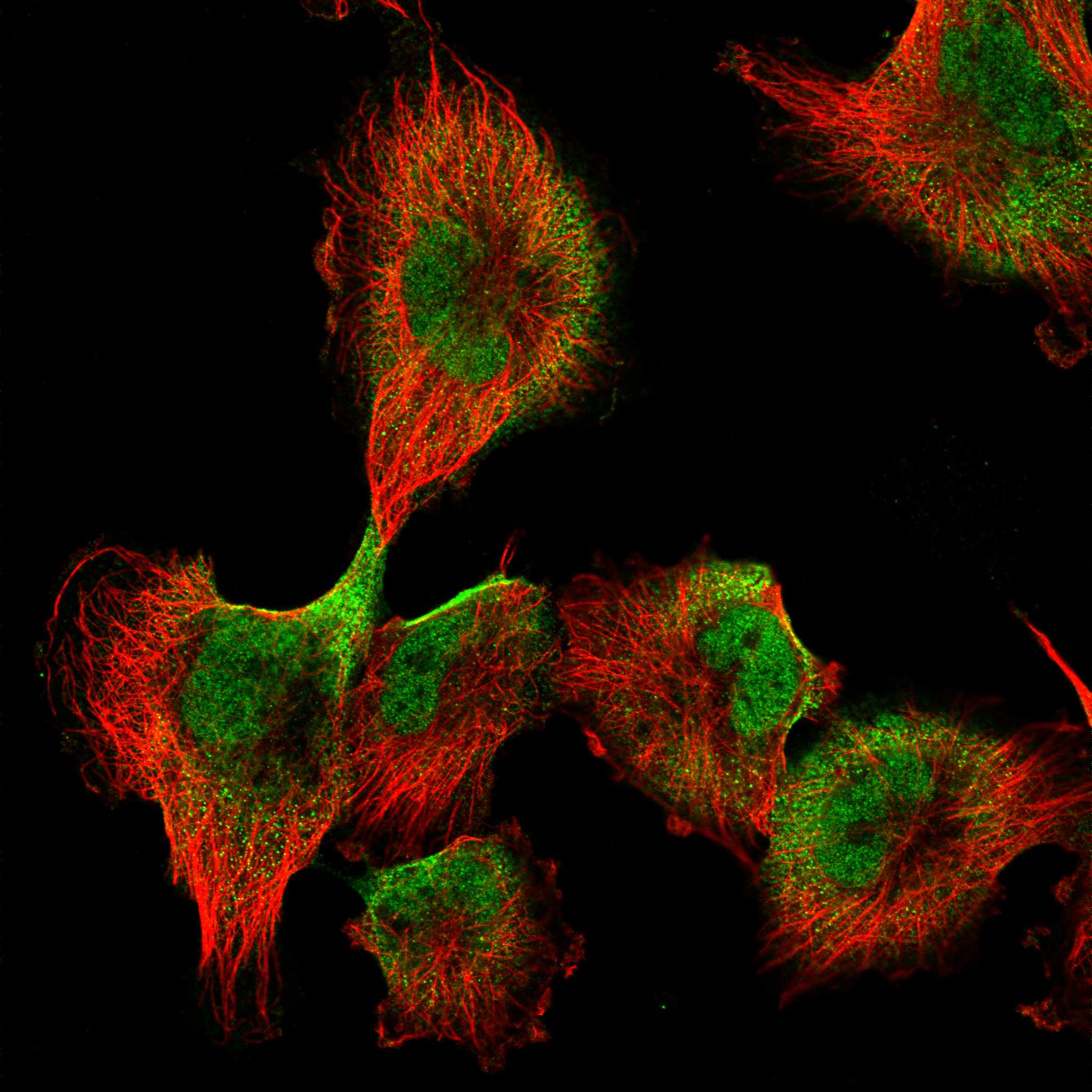 Subcellular RAI14 The Human Protein Atlas