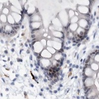 HPA IHC Colon — SRGAP3