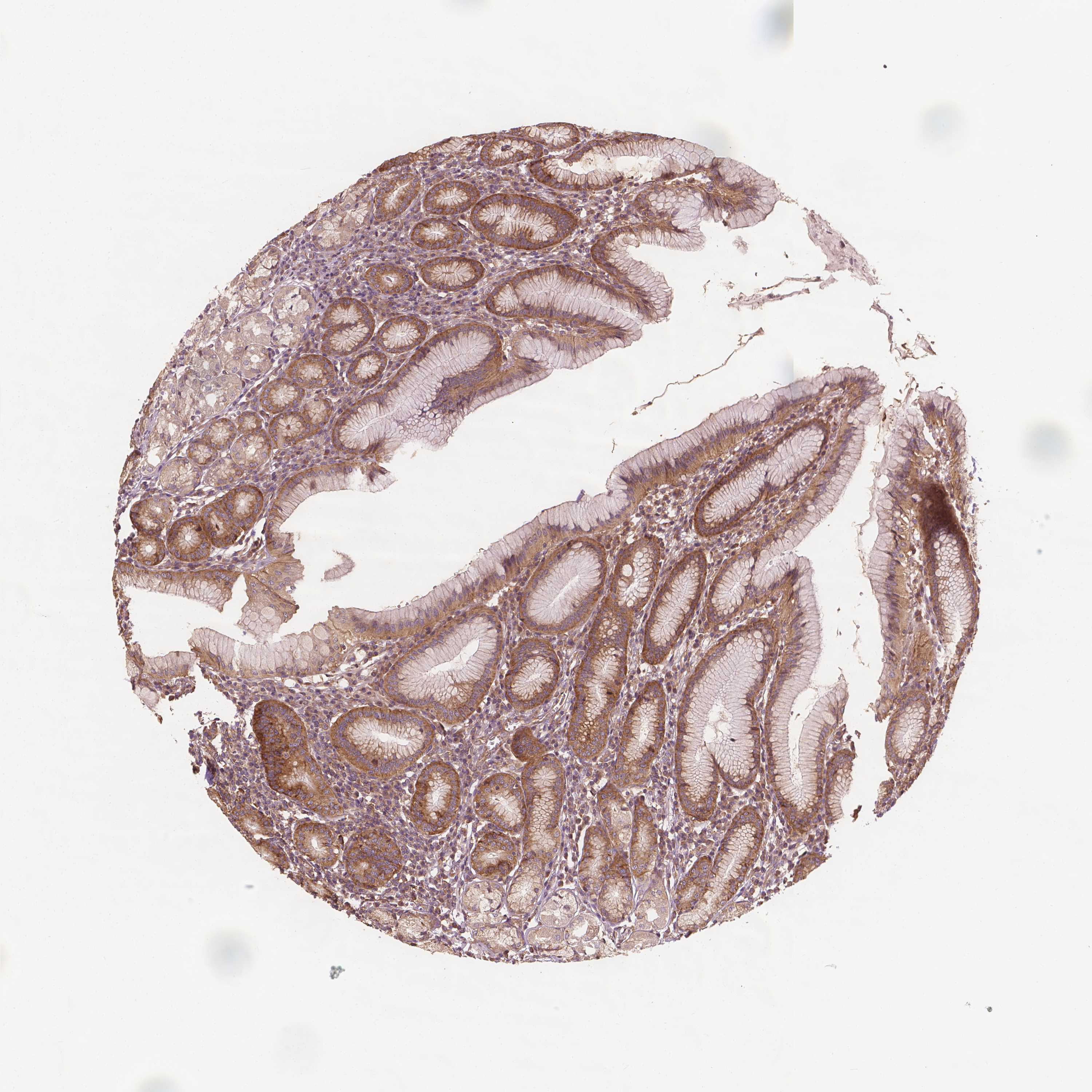 Tissue expression of G3BP1 Staining in stomach The Human Protein Atlas