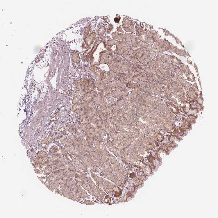 Tissue expression of G3BP1 Staining in stomach The Human Protein Atlas
