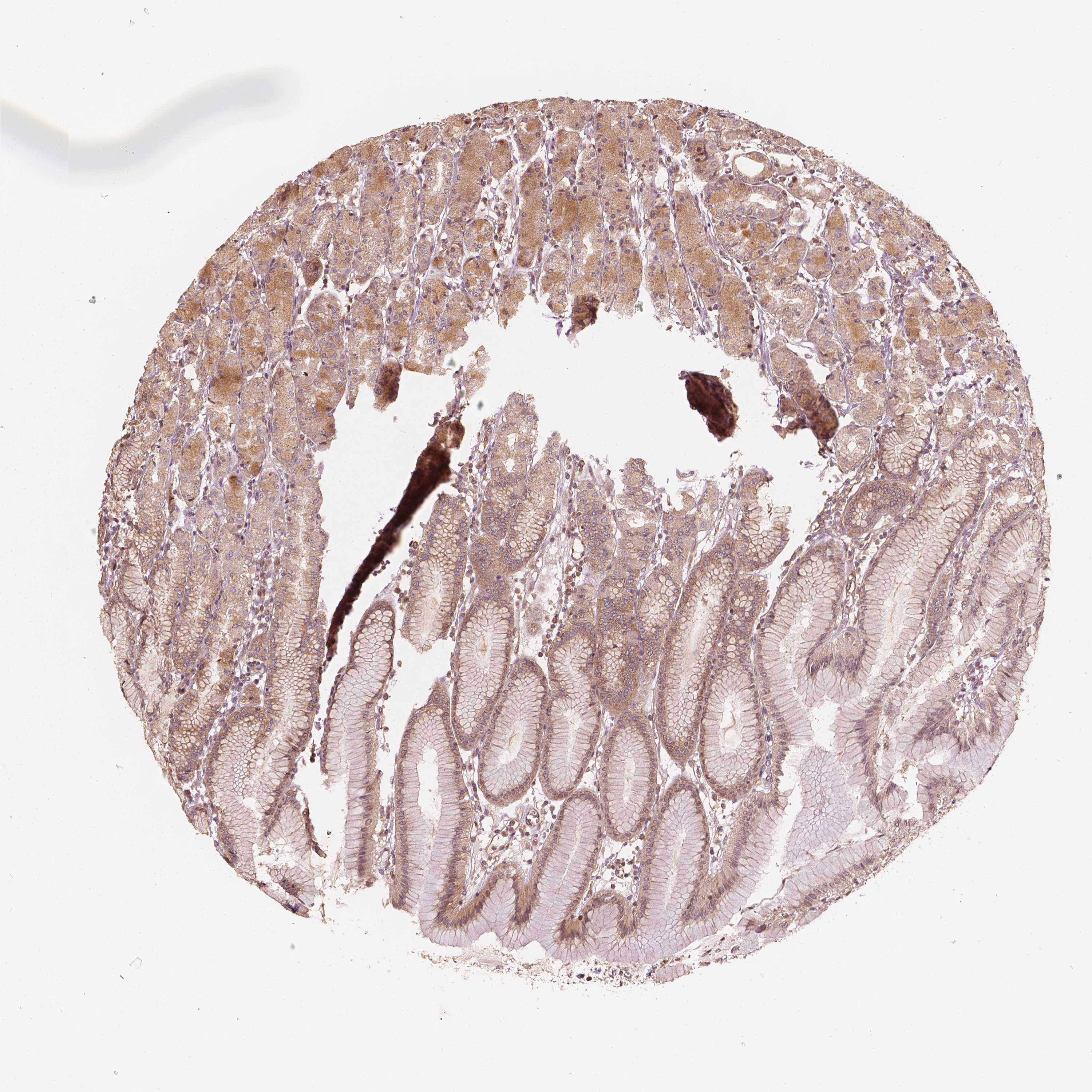 Tissue expression of G3BP1 Staining in stomach The Human Protein Atlas