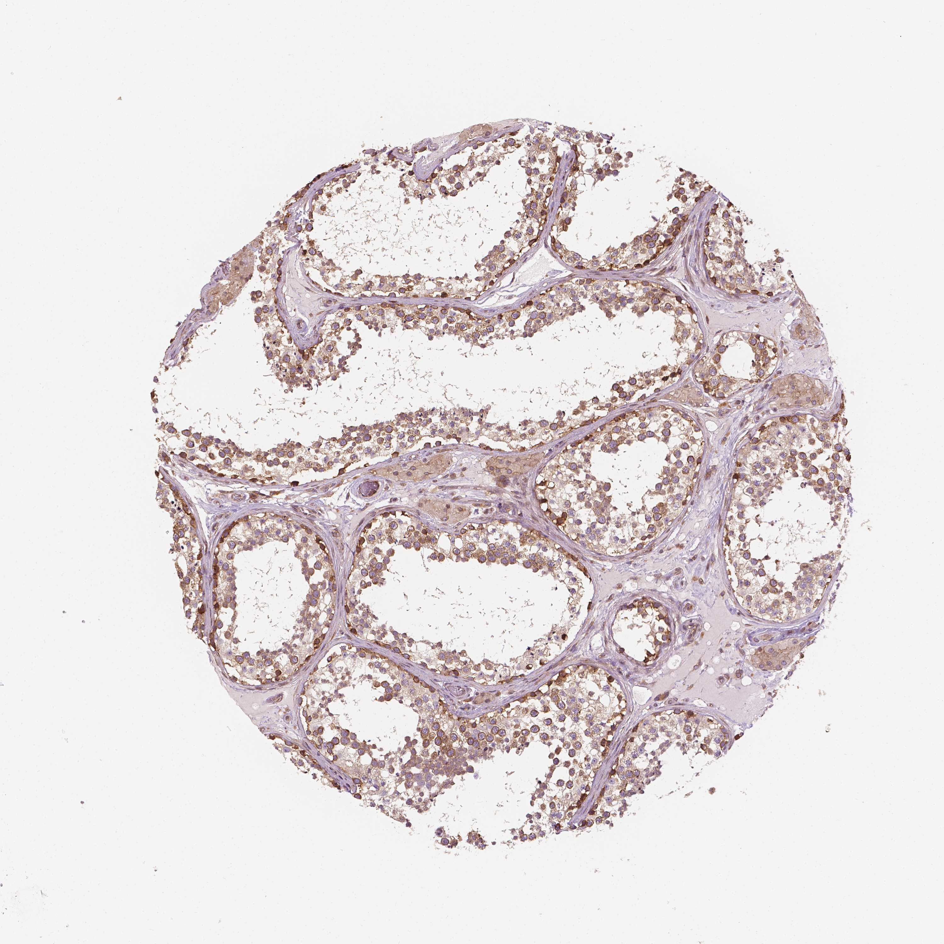 Tissue expression of G3BP1 Staining in testis The Human Protein Atlas