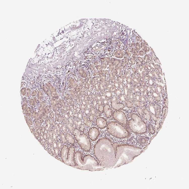 Tissue expression of G3BP1 Staining in stomach The Human Protein Atlas